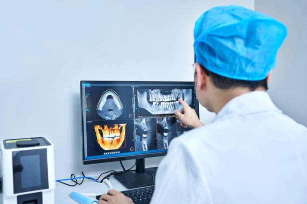 Best Emergency Tooth Extraction in Marietta, GA